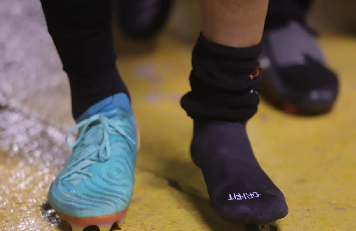 Así de inflamado le quedó el tobillo izquierdo a Jhow Benavídez. En su lugar ingresó Daylor Cacho y sería baja en la vuelta ante Olimpia.