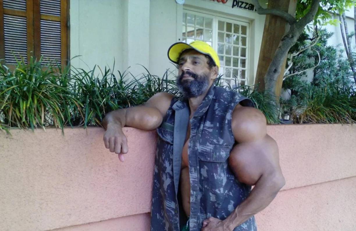 Valdir Segato, el fisiculturista al que todos decían el “Hulk brasileño”, falleció el día en que justamente celebraba un año más de vida.