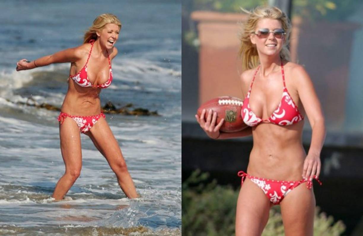 <br/>Hace años Reid se sometió a una intervención en el abdomen que le dejó marcas, en una alfombra roja su vestido se resbaló y quedó al descubierto su pecho, con cicatrices de una cirugía.