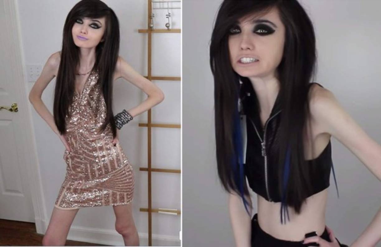 Adversarios&nbsp;del&nbsp;sitio&nbsp;dicen&nbsp;que&nbsp;su&nbsp;extrema&nbsp;delgadez,&nbsp;que&nbsp;es&nbsp;evidente&nbsp;en&nbsp;sus&nbsp;múltiples videos,&nbsp;incita&nbsp;a&nbsp;su&nbsp;joven&nbsp;audiencia&nbsp;a&nbsp;la&nbsp;anorexia