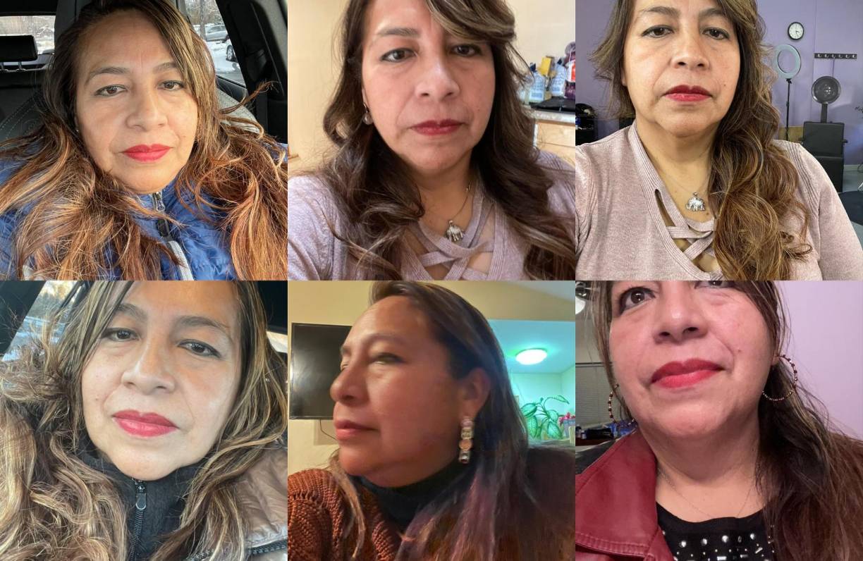 Los familiares denunciaron que Fidel Bernaola había exigido 50 mil soles por la operación, una cifra que consideraron exorbitante. También señalaron que tanto el médico como la clínica inicialmente se negaron a proporcionar detalles claros sobre el estado de salud de la paciente.