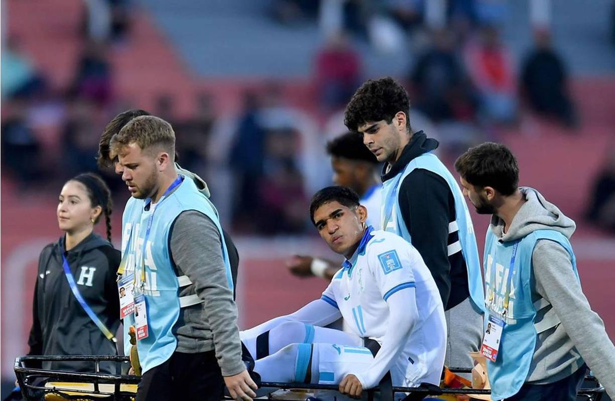 El delantero de la Sub-20 de Honduras salió del terreno de juego en camilla.