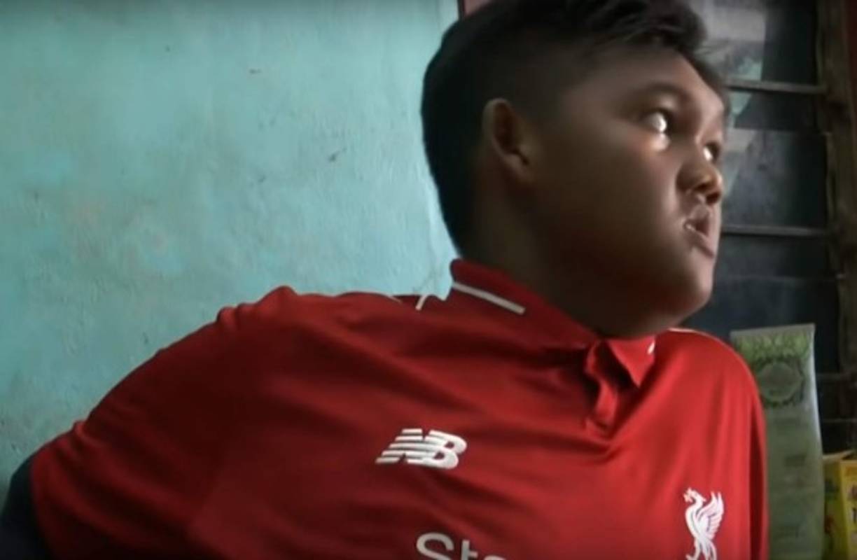 Las imágenes reveladas muestran el impactante cambio que tuvo el niño, que hace dos años era considerado el más obeso del mundo.