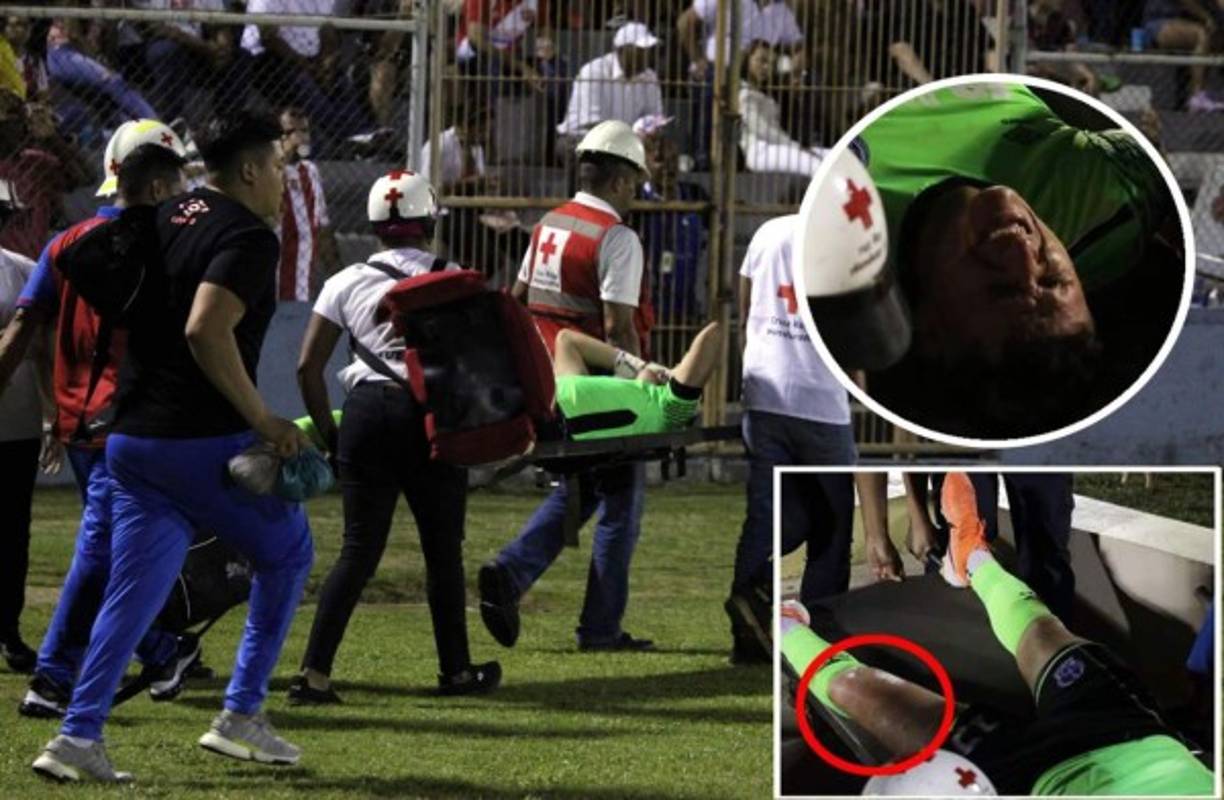 El dolor en el rostro de Harold Fonseca era evidente.