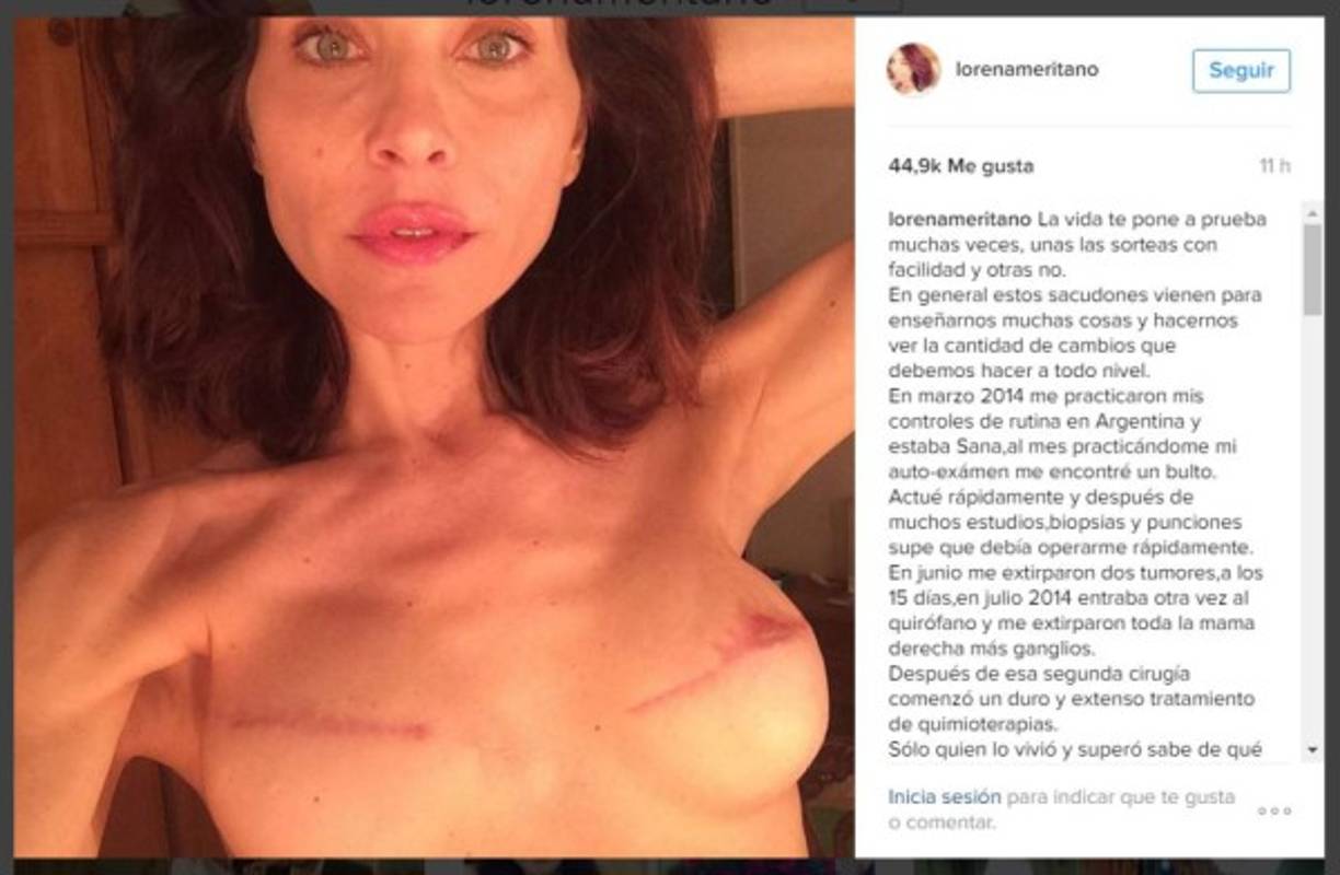 La actriz se mostró sin filtros durante su batalla contra el cáncer.