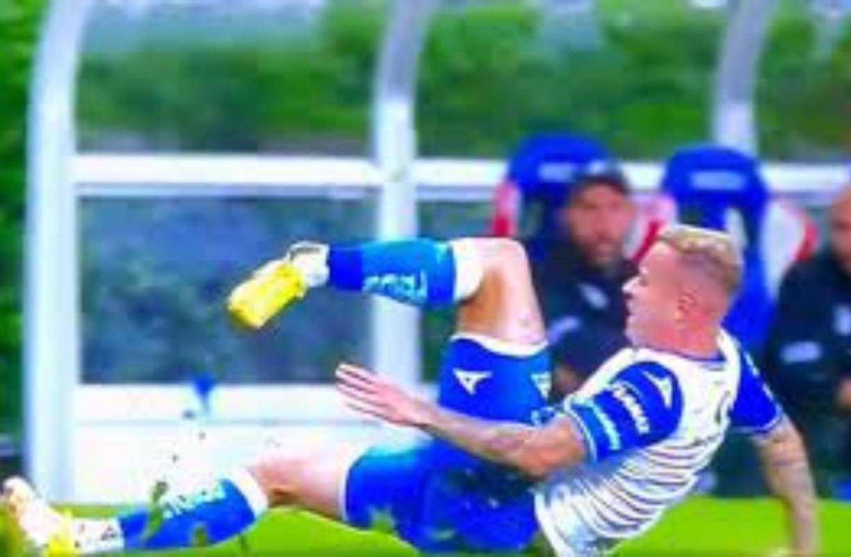 El jugador del Puebla sufrió una espeluznante lesión que le ha dado la vuelta al mundo.