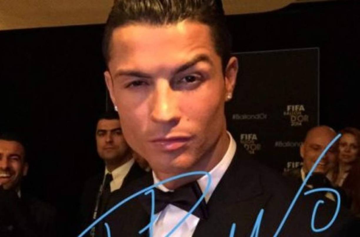 Las cejas de Cristiano Ronaldo antes estaban más caídas, por lo que se trató con frontoplastía endoscópica, para subir y reafirmar las cejas.