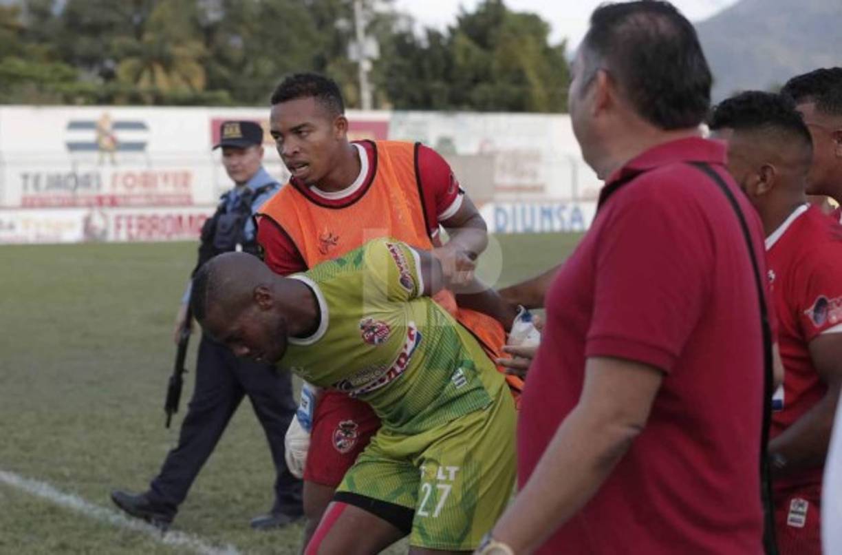 Parte de los jugadores de la Real Sociedad tuvieron que controlar a Robledo ya que pretendía golpear a Robbie Matute.