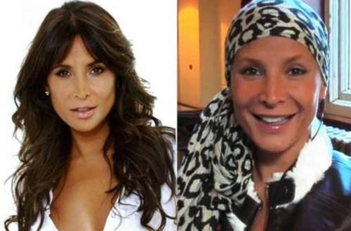 Lorena Rojas - muerte 16 de febrero de 2015<br/>Edad de muerte 44 años<br/>La actriz mexicana que brilló en telenovelas como El Cuerpo del Deseo enfrentó por años la enfermedad desde que en 2008 le fue diagnosticado cáncer de mama. Aunque lo superó dos años después, en 2011, regresó como metástasis en huesos e hígado. Rojas falleció en febrero de 2015 en Miami (EEUU) y dejó huérfana a una una bebé que adoptó en octubre de 2013.<br/>