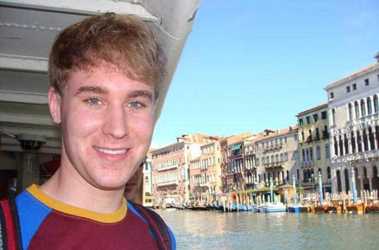 Sheldon gastó más de cien mil dólares en cirugías cuyo objetivo eran asemejarse al cantante canadiense.