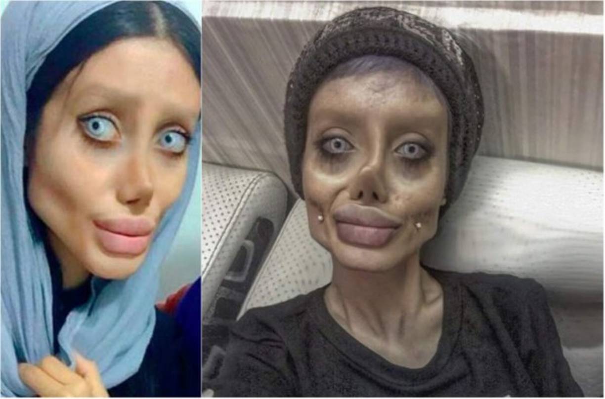 La joven iraní Sahar Tabar alcanzó la fama en redes sociles tras viralizarse unas fotos en las que, según sus seguidores, mostraba un gran parecido a la actriz estadounidense Angelina Jolie disfrazada de zombie.