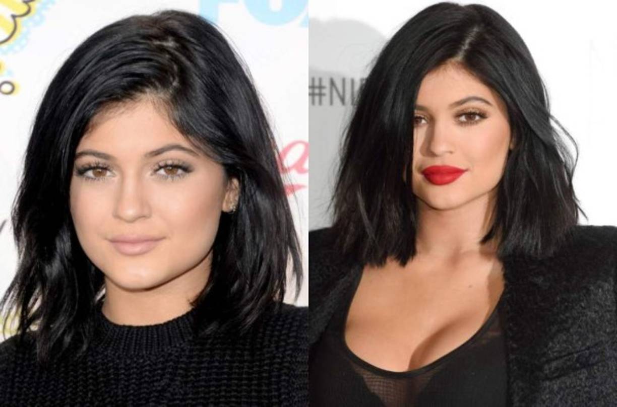 Según medios internacionales, la joven se ha realizado aumento de labios, corrección de ojos; transformó sus cejas y se estilizó la barbilla, entre otras.