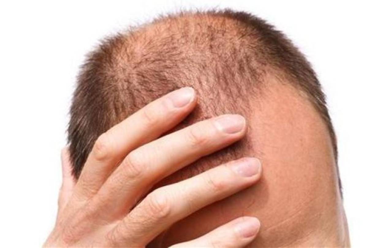 Masajea el cuero cabelludo, el cuello, las sienes, las aletas de la nariz y los lóbulos de las orejas: masajear estas zonas mejora la circulación sanguínea y rebaja la tensión. Simplemente haz una ligera presión con las yemas de los dedos y dibujando círculos. Otra opción es usar dos pelotas de tenis en un calcetín o algo similar, echarnos boca arriba y colocar las dos pelotas justo debajo de la base del cráneo (hueso occipital) y relájate.