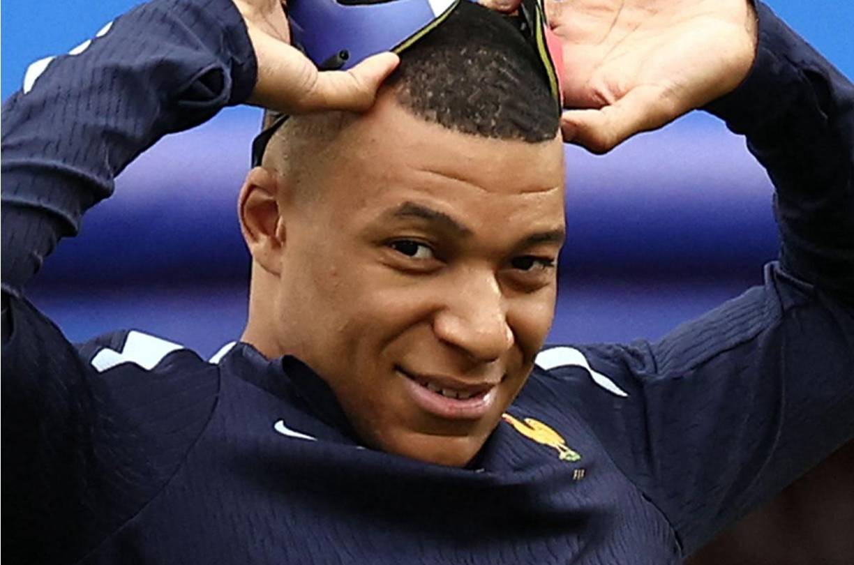 Así luce la nariz de Kylian Mbappé días después de la fractura que sufrió.