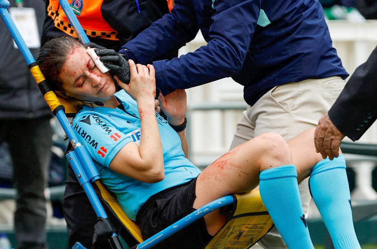 Una árbitra sufrió un impactante accidente durante el partido Real Betis vs Athletic Club por la Liga de España. 