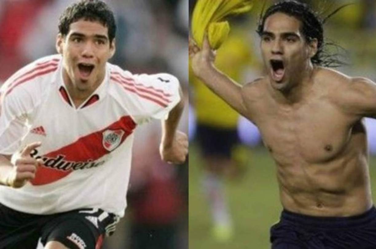 Radamel Falcao: En el 2014, el colombiano se sometió a una operación de nariz, aunque no sólo lo hizo de manera estética, sino para poder respirar bien.