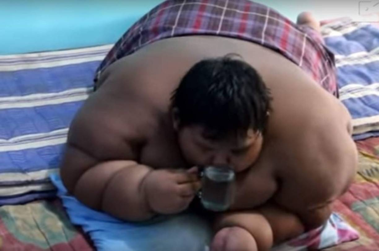 El niño, que vive en Indonesia junto a su familia, llegó a pesar 200 kilos (440 libras)