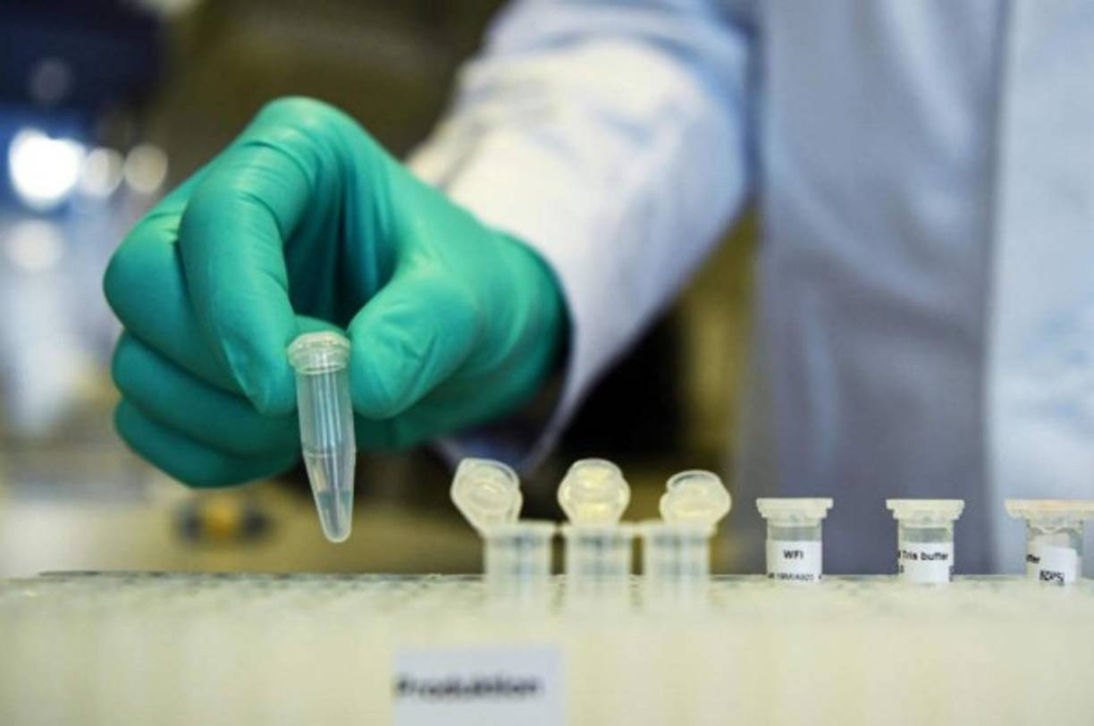 Los investigadores estudiaron 107 hombres y 94 mujeres que dieron positivo en la prueba de COVID-19 entre los meses de enero y febrero.