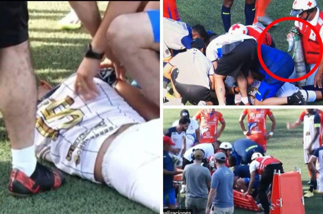 Cristian Viery, jugador de Potros, ingresó al minuto 60 del partido. Y minutos después sufrió un fuerte golpe en la cabeza en un jugada donde al parecer impactó en la rodilla del futbolista de los Lobos.