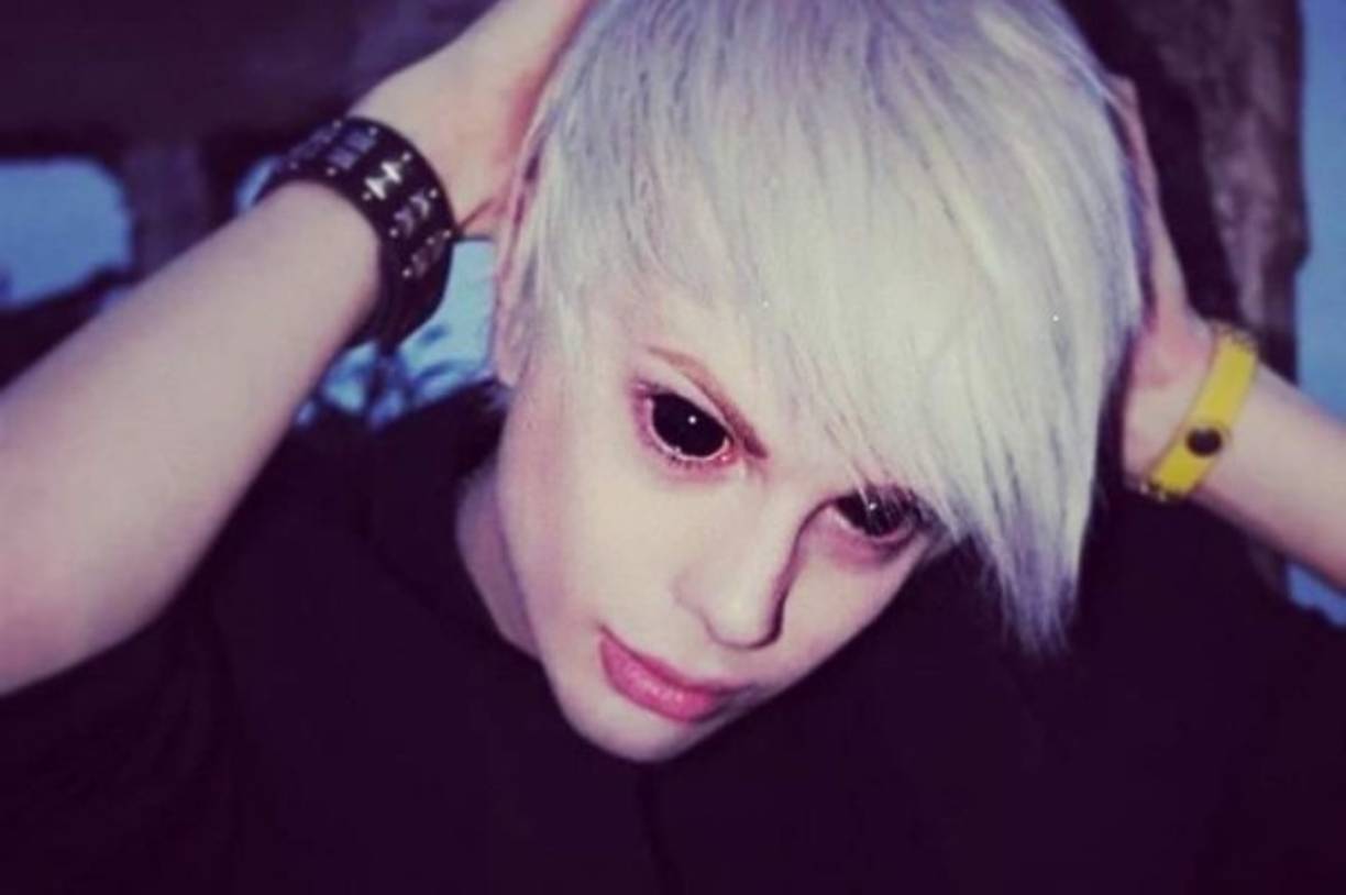 A sus 25 años, usa una prótesis de orejas de punta y se hizo un trasplante de cabello.