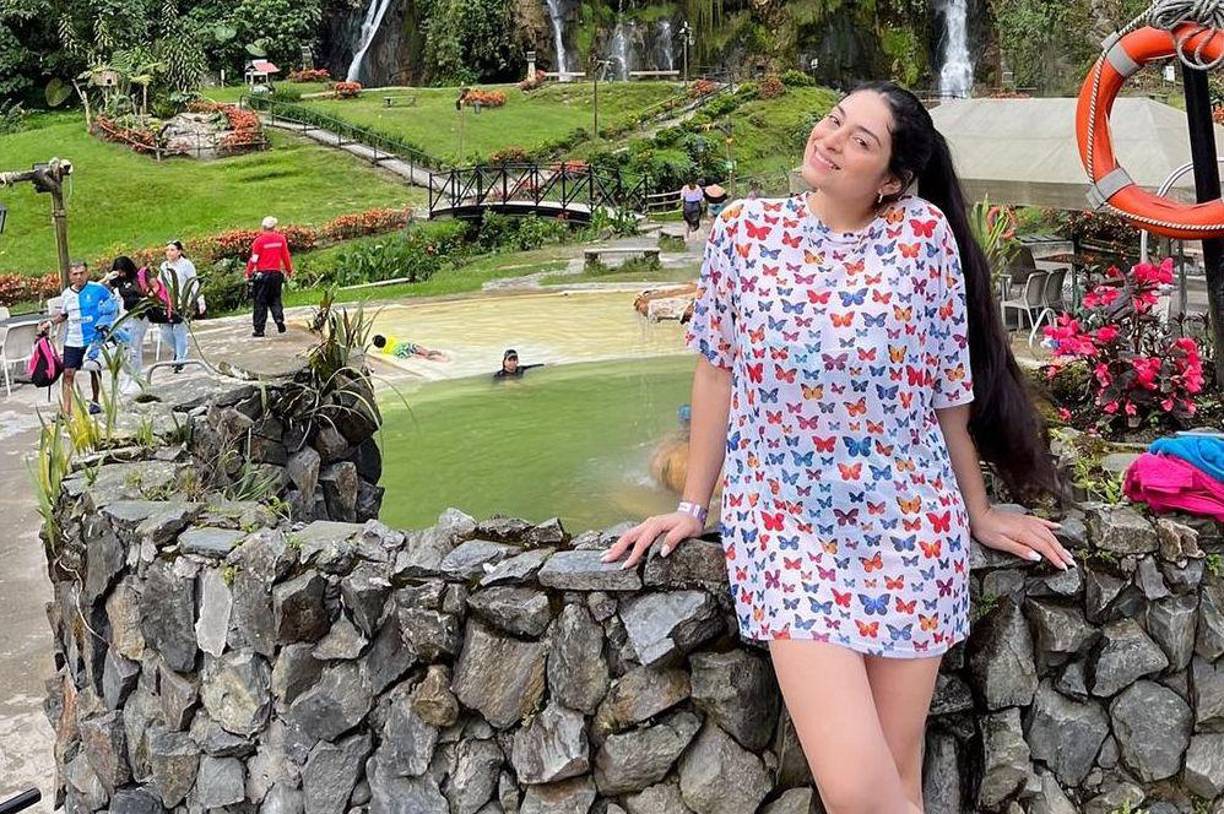 El brutal impacto con las barandas provocó que las piernas de Salomé fueran cercenadas por completo. 