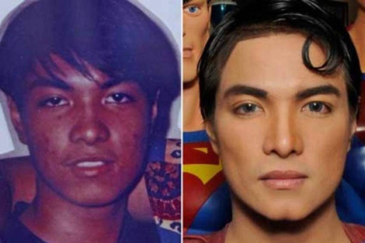 Herbert Chavez (39) es un hombre filipino cuya fascinación por el personaje de Superman lo ha llevado a realizarse más de 25 operaciones. En la imagen, el Chavez adolescente antes de operarse junto al Chavez transformado en Superman.