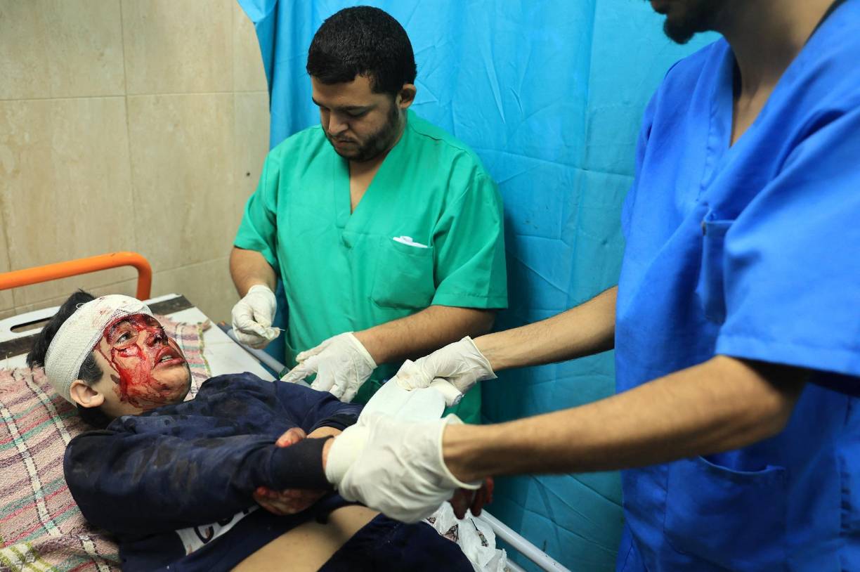 Las tropas israelíes desplegadas en el lugar “incluyen equipos médicos arabófonos, que han recibido un entrenamiento específico para prepararse para este entorno complejo y sensible, con la intención de que no se cause daño a los civiles que Hamás utiliza como escudos humanos”, aseveró Hagari.