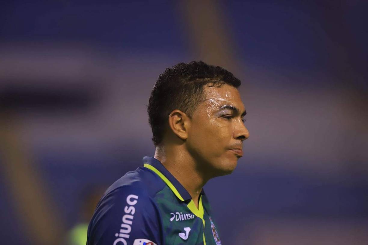 Así terminó jugando Sergio Peña el Clásico ante Olimpia.