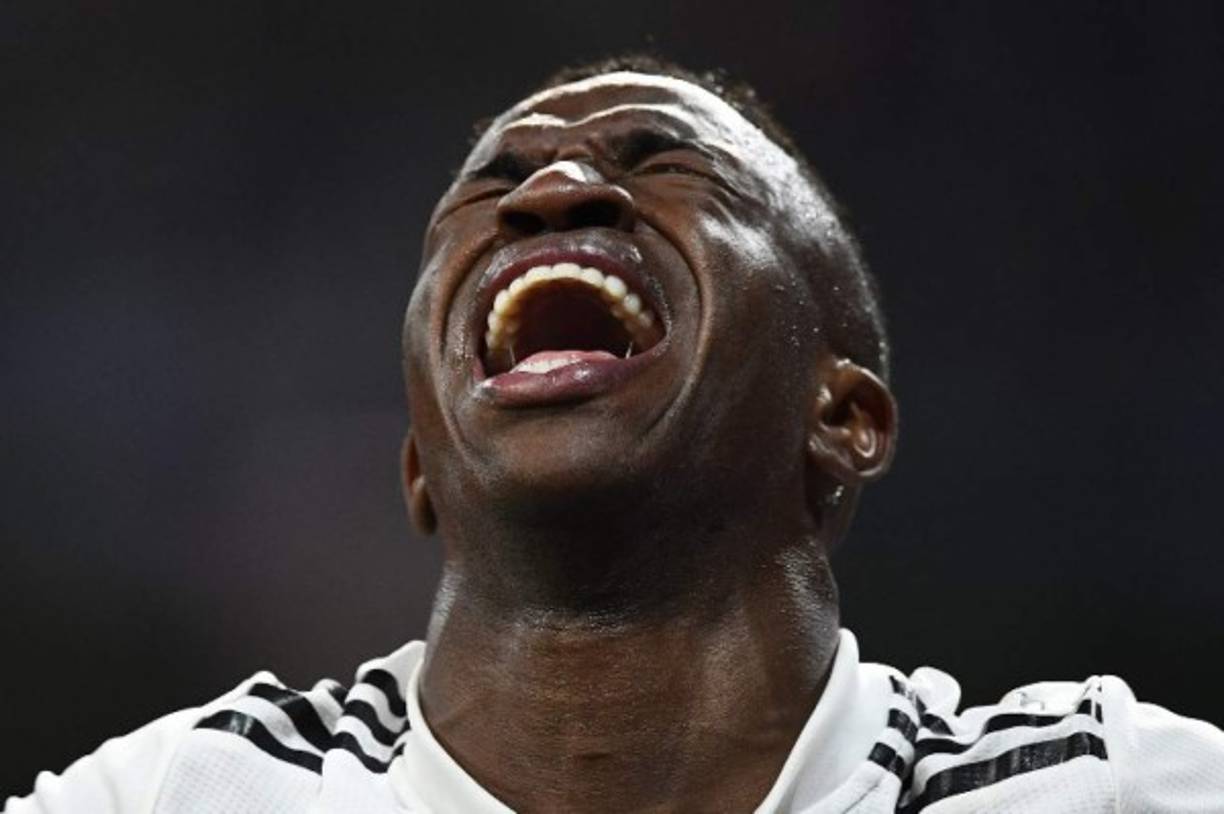 En Real Madrid las cosas no estaban bien y siguió recibiendo duros golpes. El brasileño Vinicius se retiró lesionado en el minuto 35, el jugador no pudo contener las lágrimas.