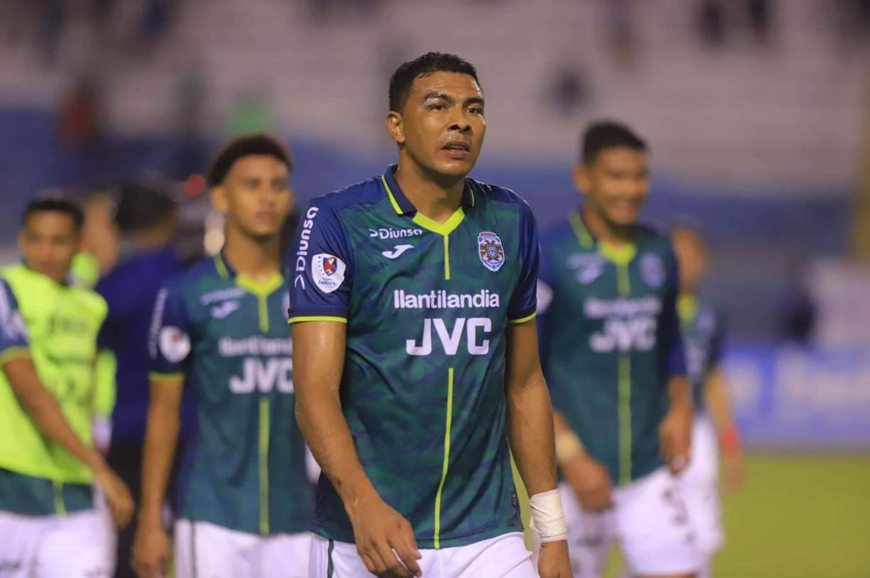 El volante de contención Sergio Peña sufrió un corte en su ceja derecha durante el Clásico.