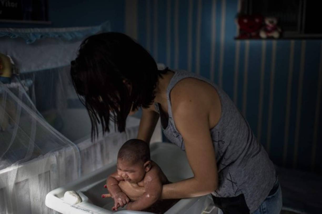 ¿Es el zika responsable de microcefalias en los recién nacidos observado en Brasil? 'El vínculo entre el zika y la microcefalia es probable, pero por el momento no ha sido probado científicamente', dice el profesor Jean-François Delfraissy, director del Instituto Nacional de Salud e Investigación Médica de Francia (Inserm).