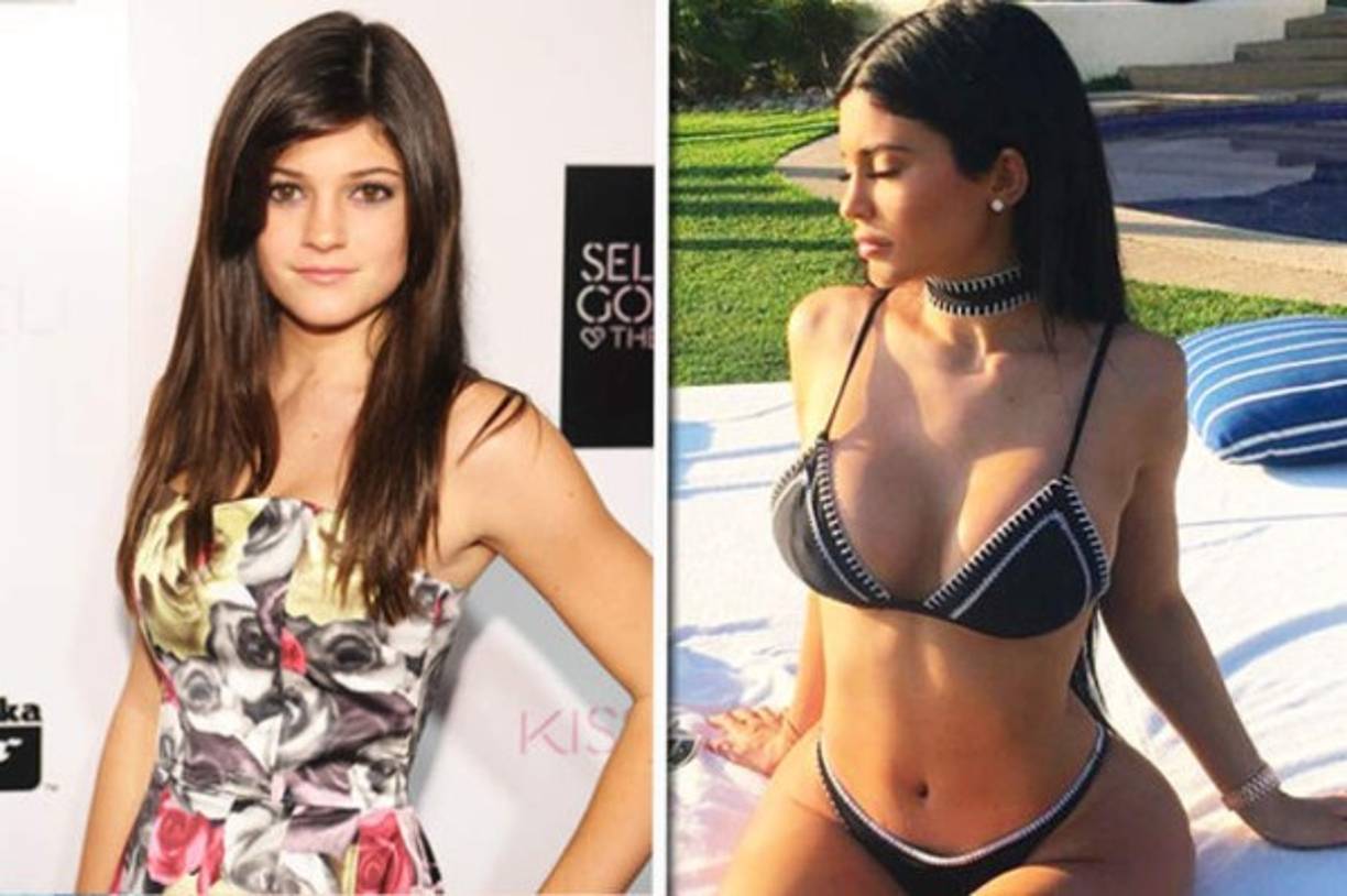 El cambio de Kylie es innegable. Su cuerpo ha sufrido muchos cambios.