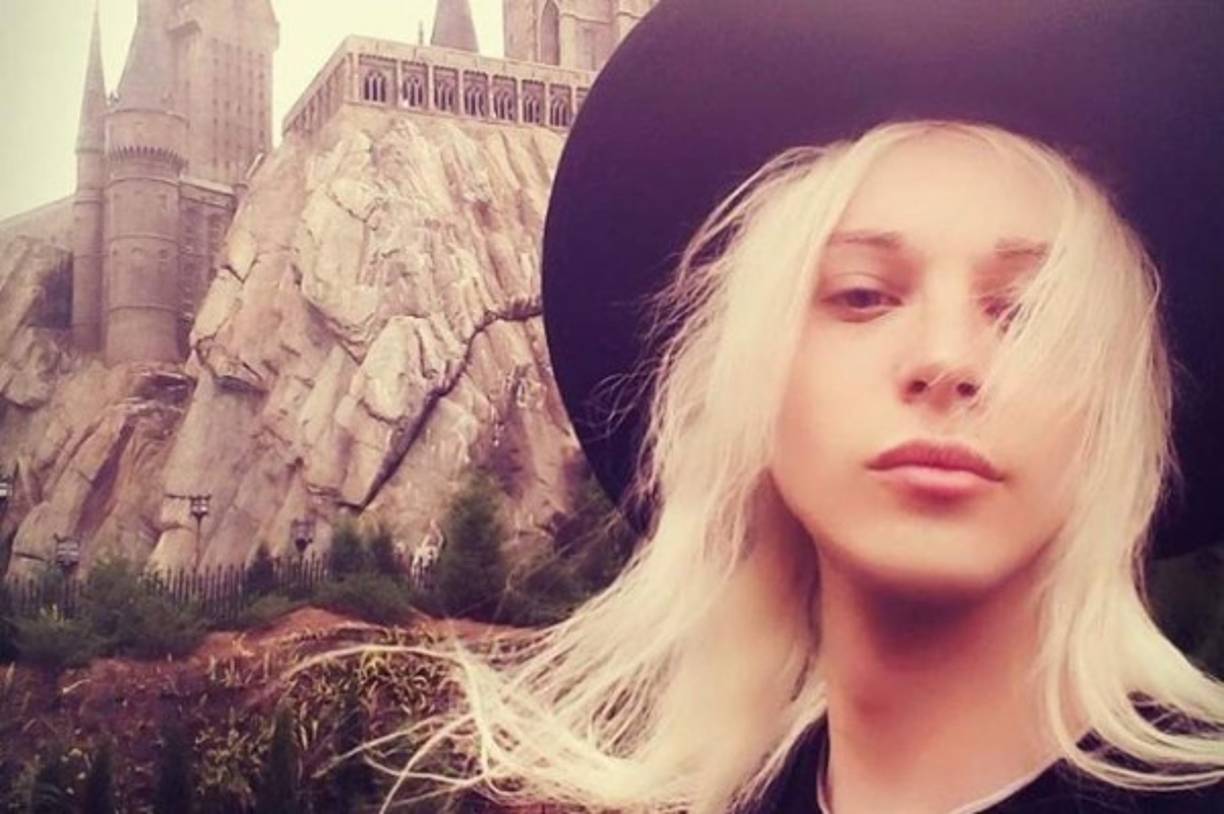 Luis también se ha sometido a intervenciones en las mejillas.