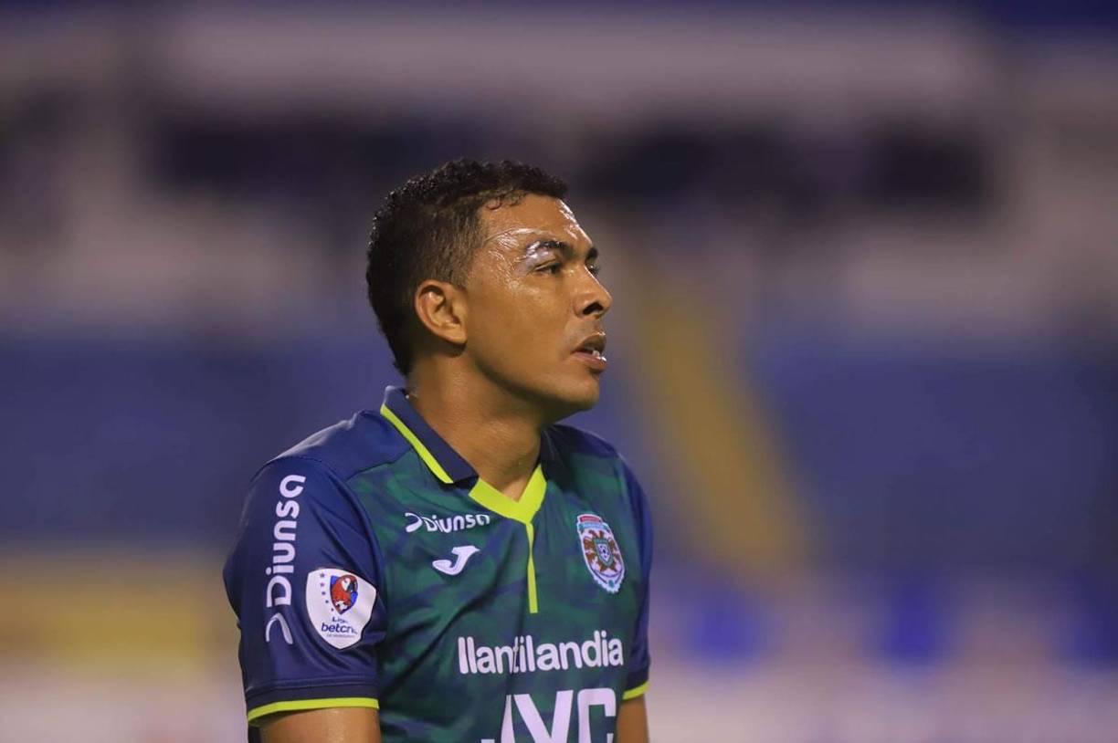 El volante de contención Sergio Peña sufrió un corte en su ceja derecha durante el Clásico.