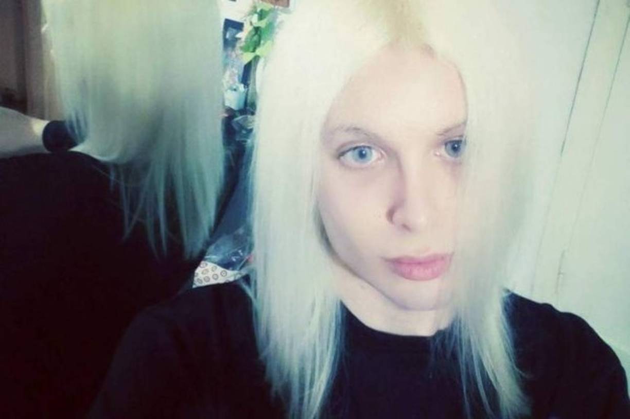 En los ojos y el cabello también se evidencian cambios.