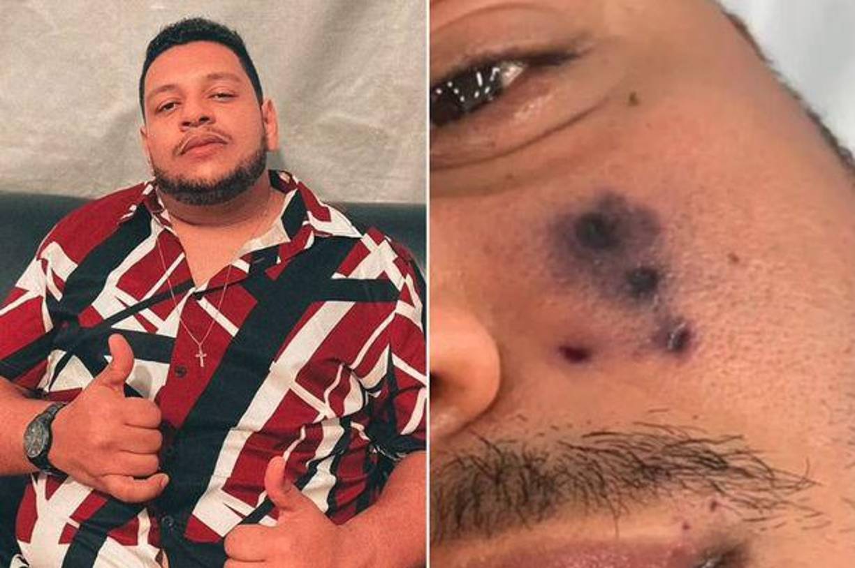 La música brasileña se encuentra de luto tras la inesperada y trágica muerte del cantante Darlyn Morais a la temprana edad de 28 años. 