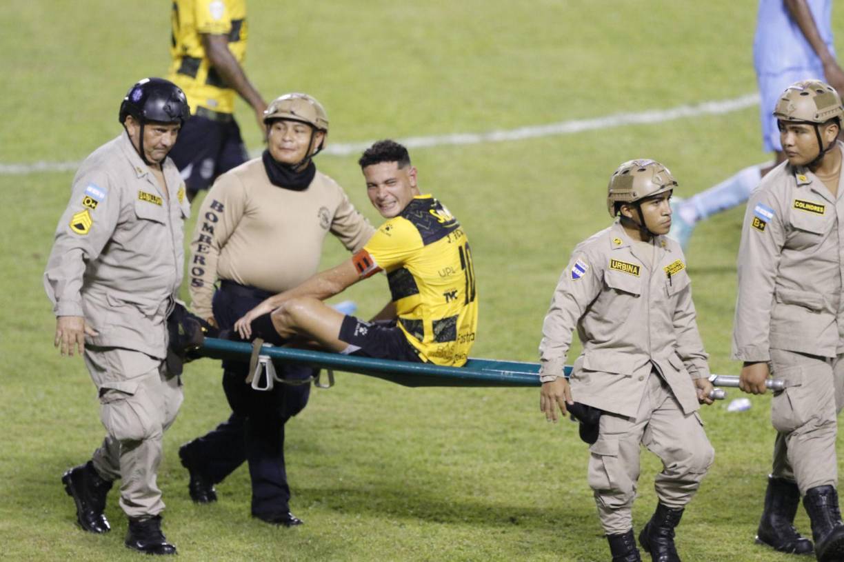 Jhow salió lesionado en el último cuarto del partido.