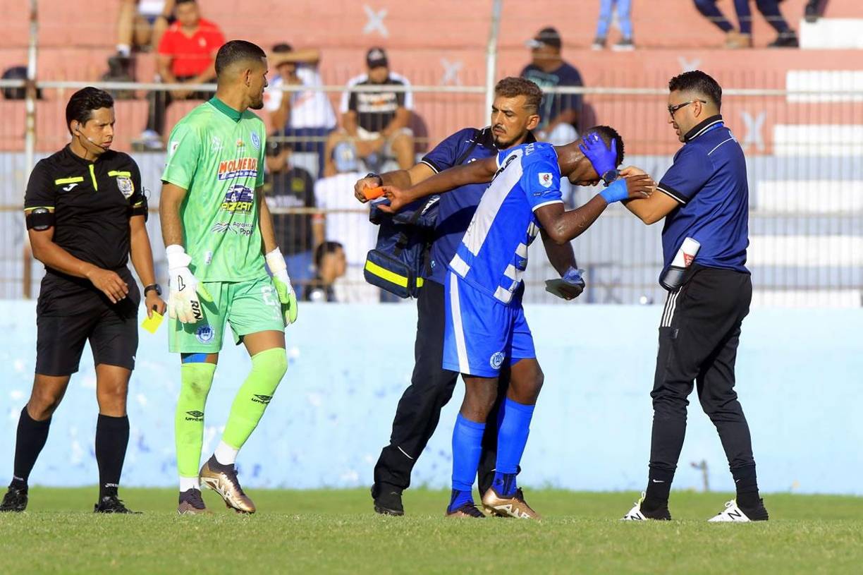 En un momento se observó a Velásquez Colón como aturdido por el tremendo golpe que se llevó en el rostro.