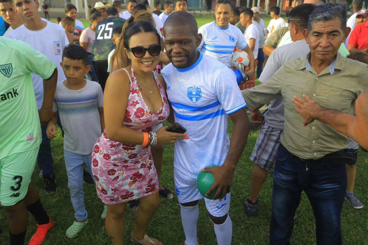 Fue impresionante ver como los pedían para la Selección actual. “Creo que hicimos algo en la Selección para que la gente nos siga a donde vayamos. Es bonito tener estos partidos porque la mayoría nos miró jugando para la Bicolor”.