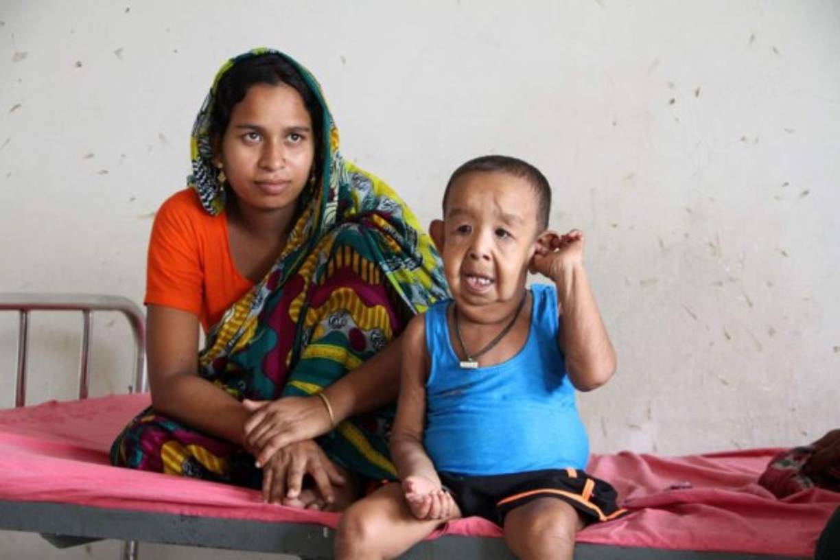 Un niño bangladesí de cuatro años con aspecto de anciano debido a una extraña enfermedad fue hospitalizado en Daca para someterse a exámenes, anunciaron los médicos y su familia. Los médicos del hospital universitario de Daca aceptaron intentar diagnosticar la enfermedad y tratar gratuitamente al niño, Bayezid Shikdar, cuyos padres son agricultores. El niño nació con un exceso de piel, que cuelga de sus miembros y de su cara, lo que le confiere una imagen de anciano. También sufre problemas cardíacos, de audición y de vista.