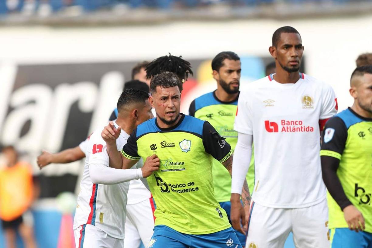 Erick Andino sangró de su pómulo derecho tras un golpe que se llevó en una jugada con José García.