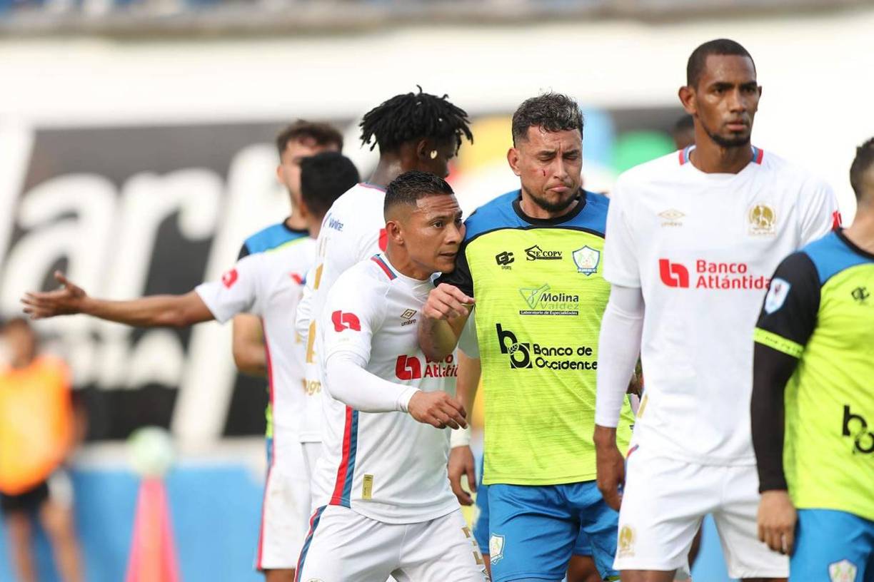 Erick Andino sangró de su pómulo derecho tras un golpe que se llevó en una jugada con José García.