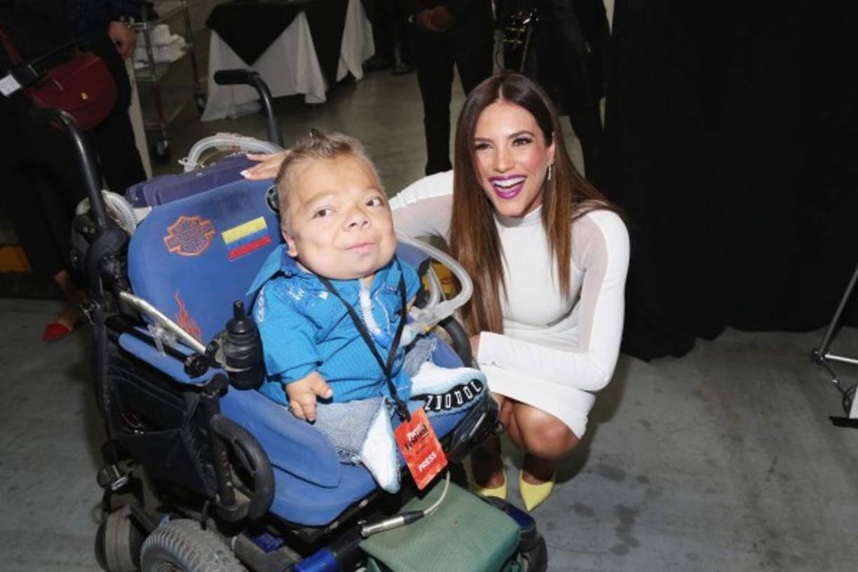 El enanismo tanatofórico es un mal en el cual las extremidades del menor, así como su corazón son pequeños, pero no así la cabeza. En la foto con Cris con Gaby Espino.