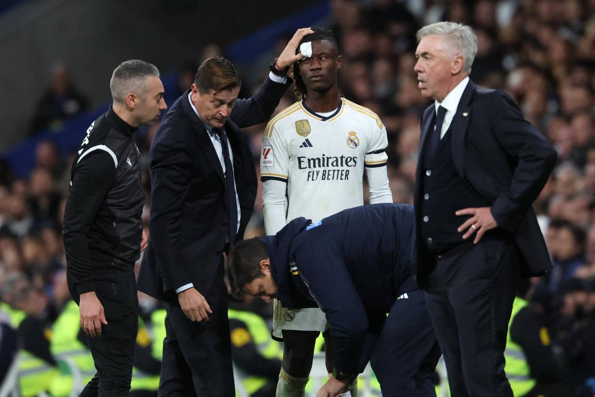 Eduardo Camavinga, en un choque con Falcao recibió un golpe en el rostro y tuvo también que ser atendido rápidamente, ya que estaba derramando sangre.