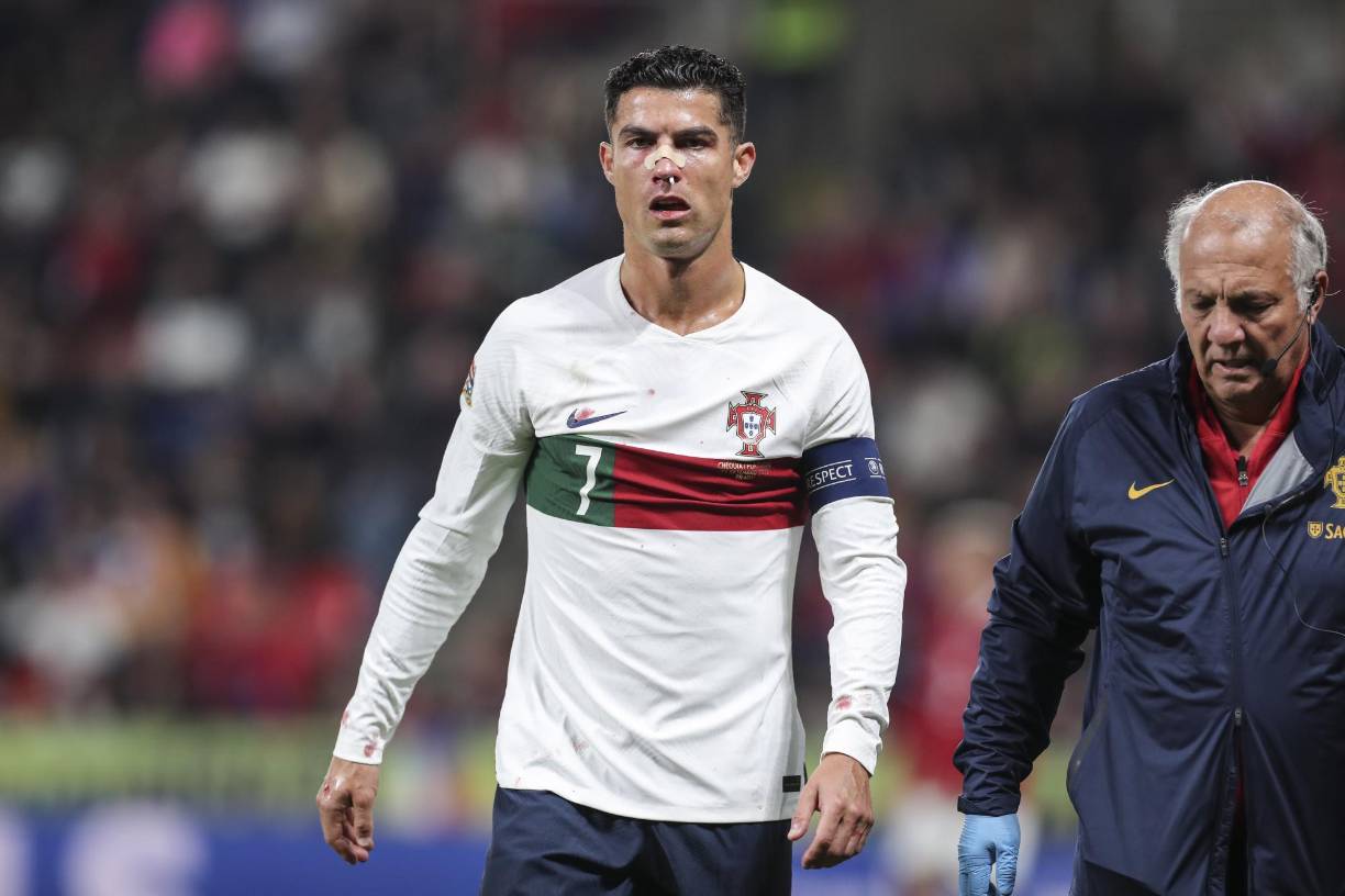 Cabe señalar que previo a la jugada CR7 estaba en evidente fuera de juego y por tal razón no se sancionó lo que era evidentemente una falta penal a favor de Portugal.