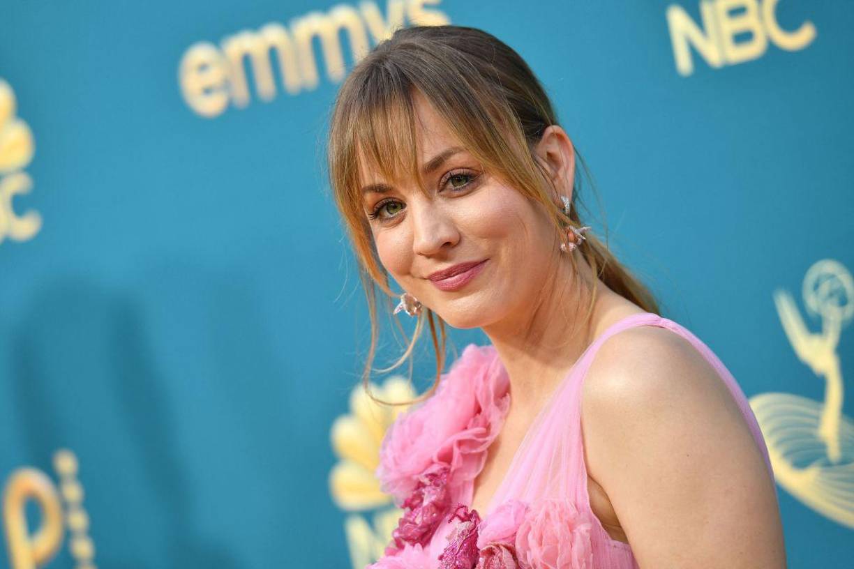  La actriz de 36 años -que espera su primer hijo con su novio Tom Pelphrey- estaba montando a caballo en un rancho de Los Ángeles en 2010, cuando se asustó y ella se cayó, antes de que el equino intentara saltar sobre ella y cayera sobre su pierna izquierda.