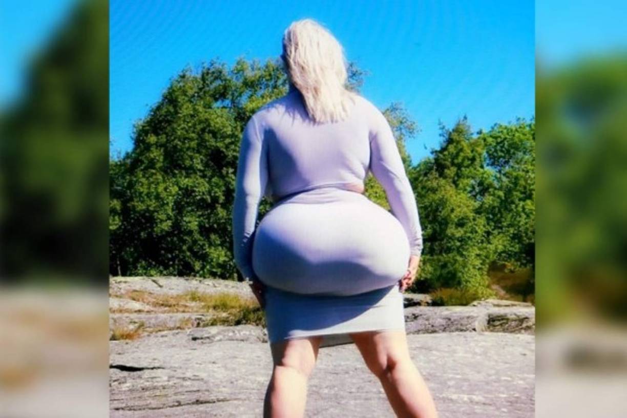 Pero este gran tamaño no solo se debe a las operaciones, también es producto de las calorías que consume a diario: helados o cosas ricas en grasas.