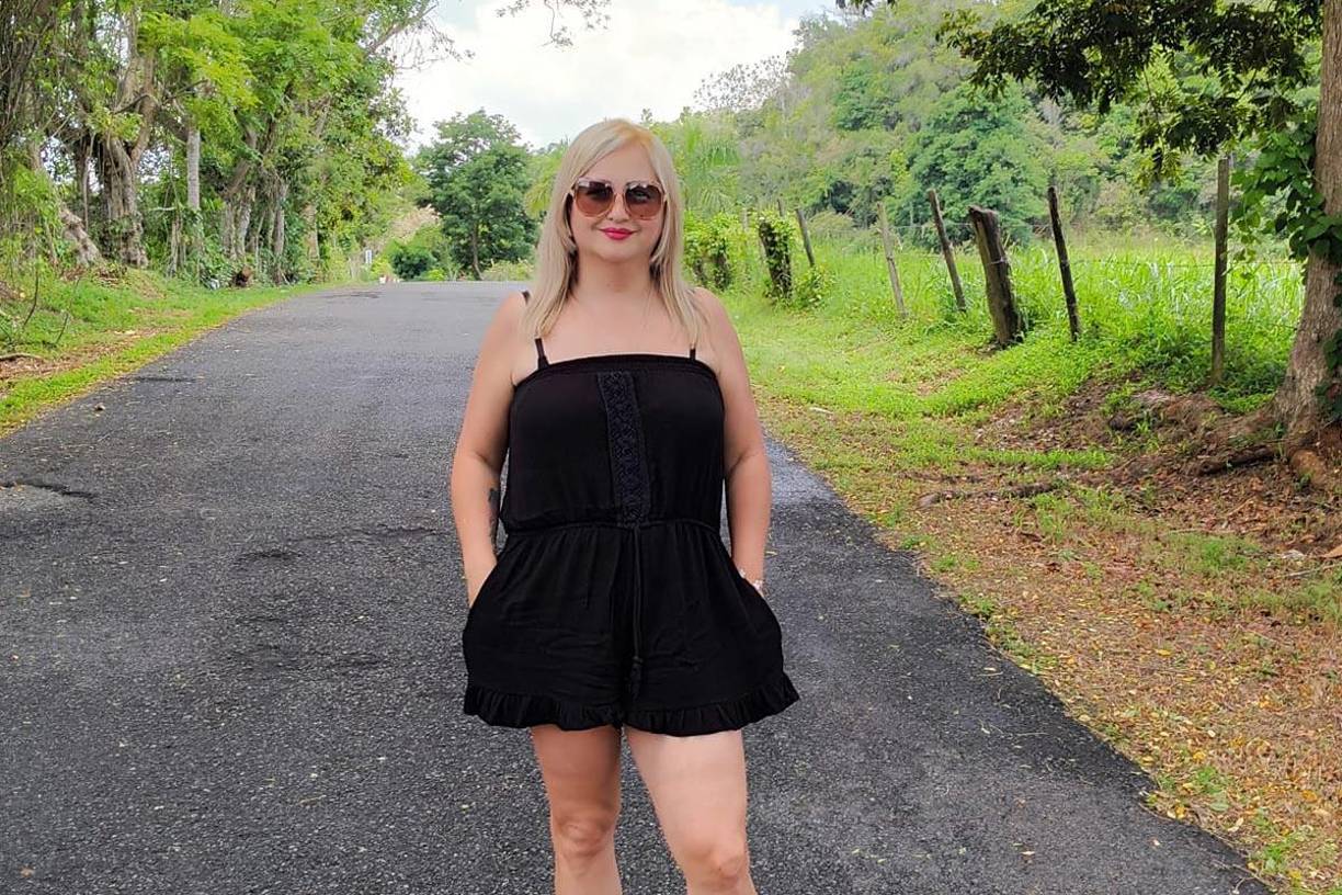  El esposo precisó que el procedimiento de liposucción de la papada fue un “regalo” por parte de la clínica.