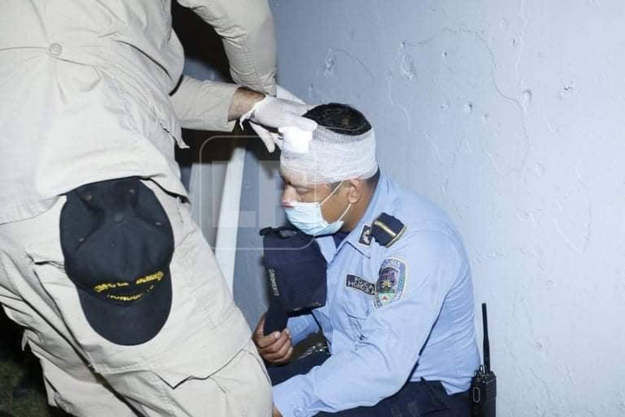 Integrantes del Cuerpo de Bomberos tuvieron que auxiliar a los miembros de la Policía Nacional que resultados heridos-