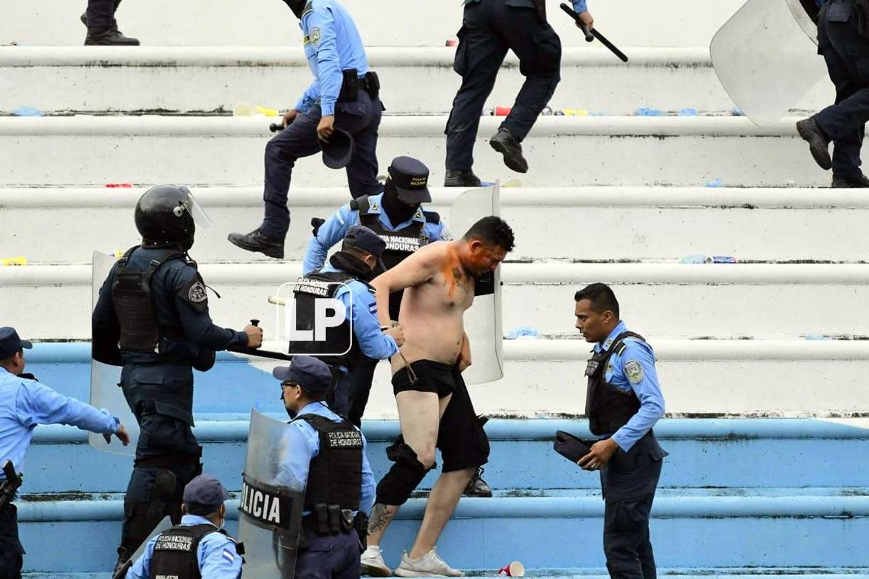 Así quedó este aficionado del Real España que trataba de protegerse de los policías.